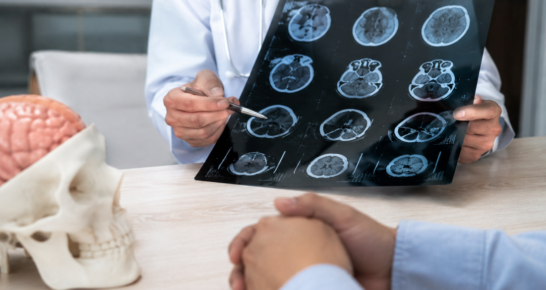 Doctor reviewing brain CT scans beside skull and brain models, illustrating traumatic brain injury diagnosis.